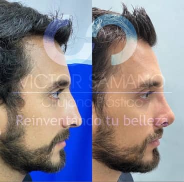 Slider image (4) Cancun Plastic Surgery Center by Dr. Víctor Sámano